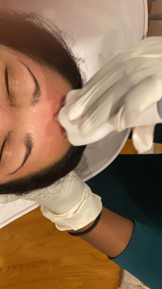 Skin Tightening- Face