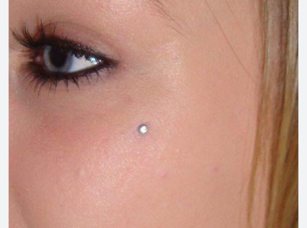 Dermal (small)