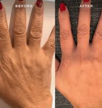 Luxurious Hand Rejuvenation