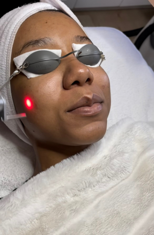 Dermaplane + Laser GLOW Facial