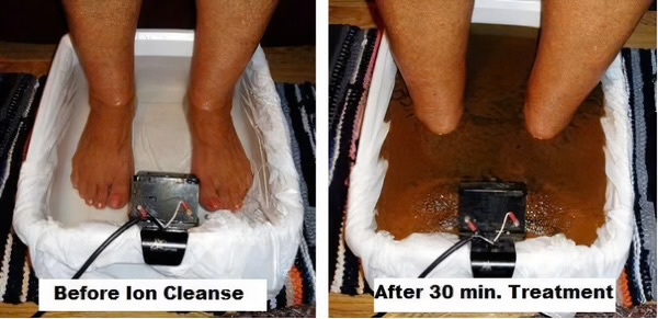 Ionic Foot Detox