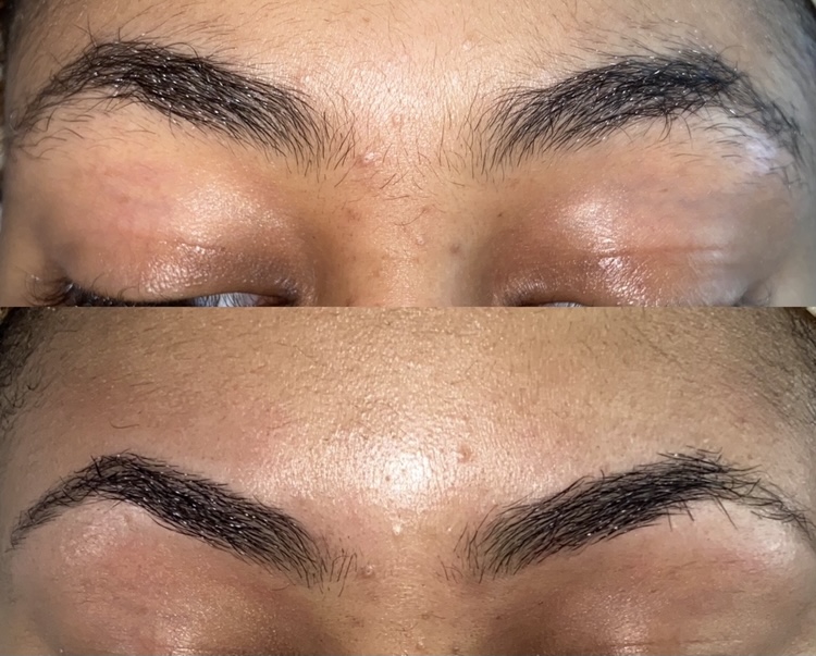 The Brow Thread