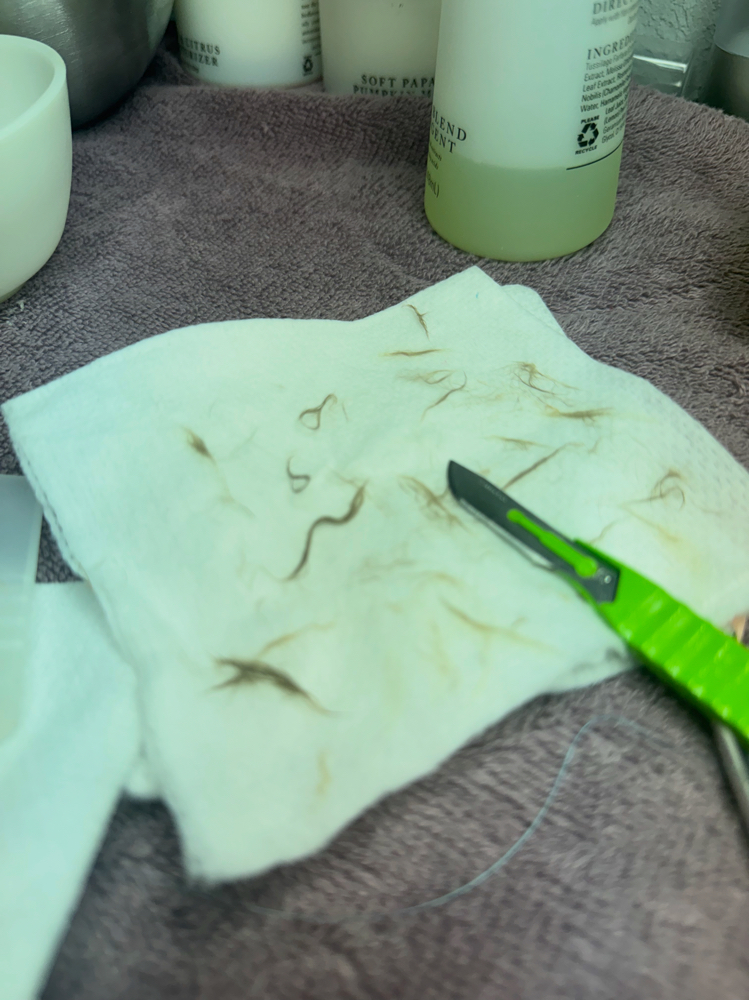 Dermaplane Treatment