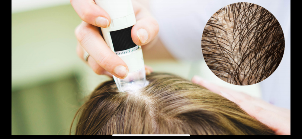 Hair & Scalp Analysis