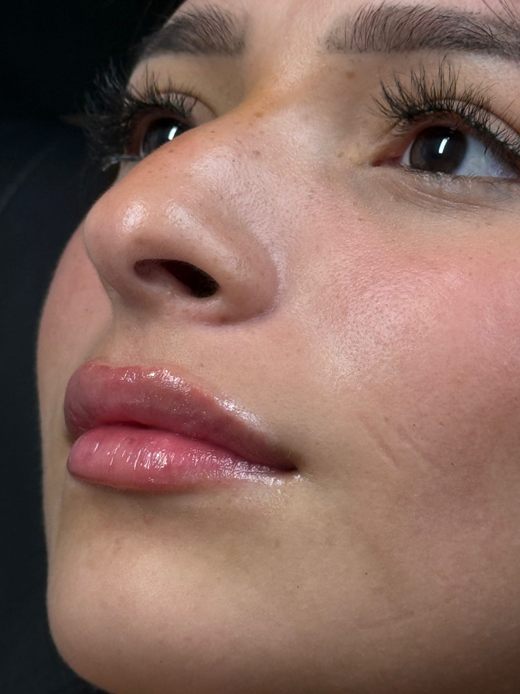 Lip Filler 1/2 Syringe at Lc Beauty Vault in Sinton, TX