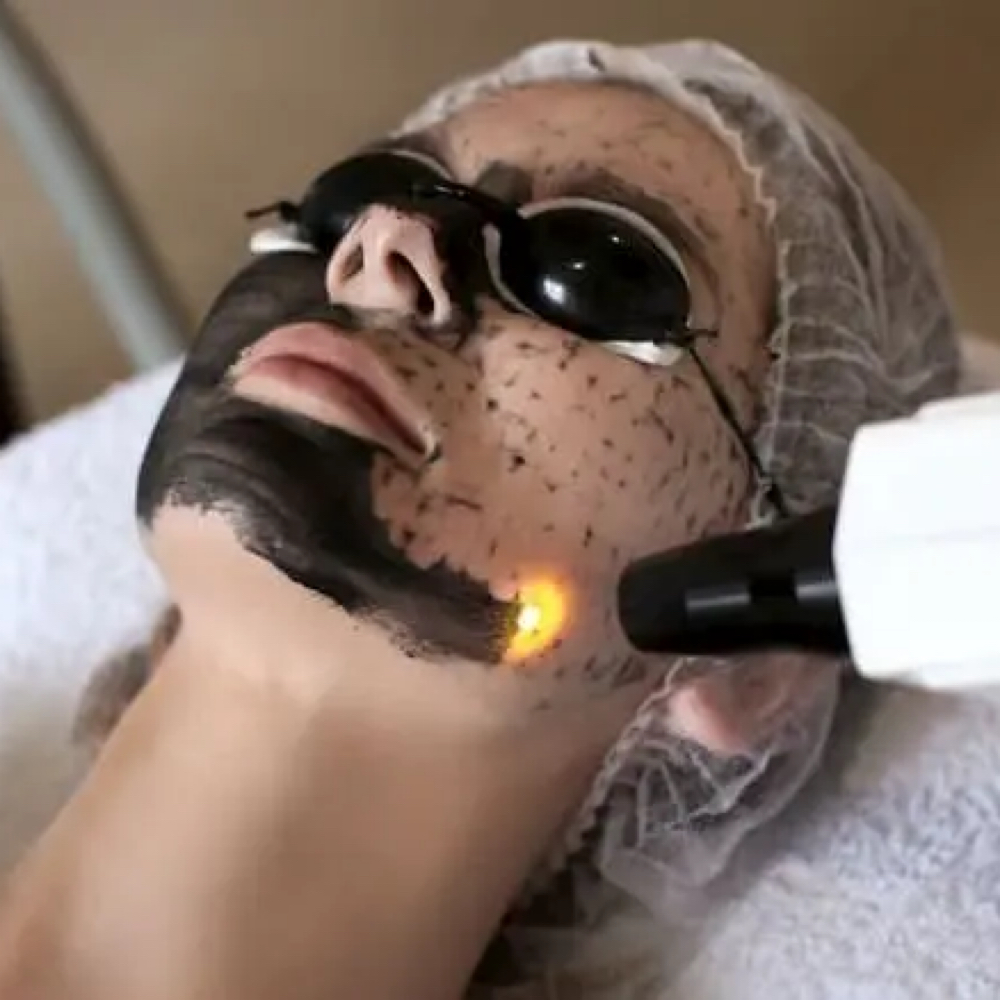 ✨Hollywood (Carbon)Facial✨May Promo at Nena’s Beauty Glow Bar in North Las Vegas, NV