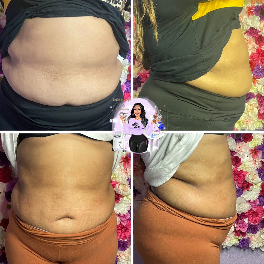 Body Treatments