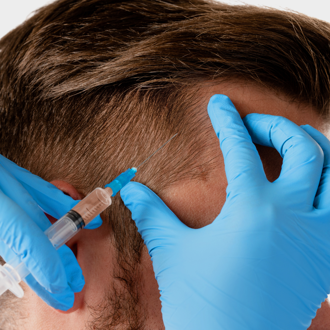 PRP Facial
