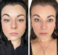 Face slimming facial