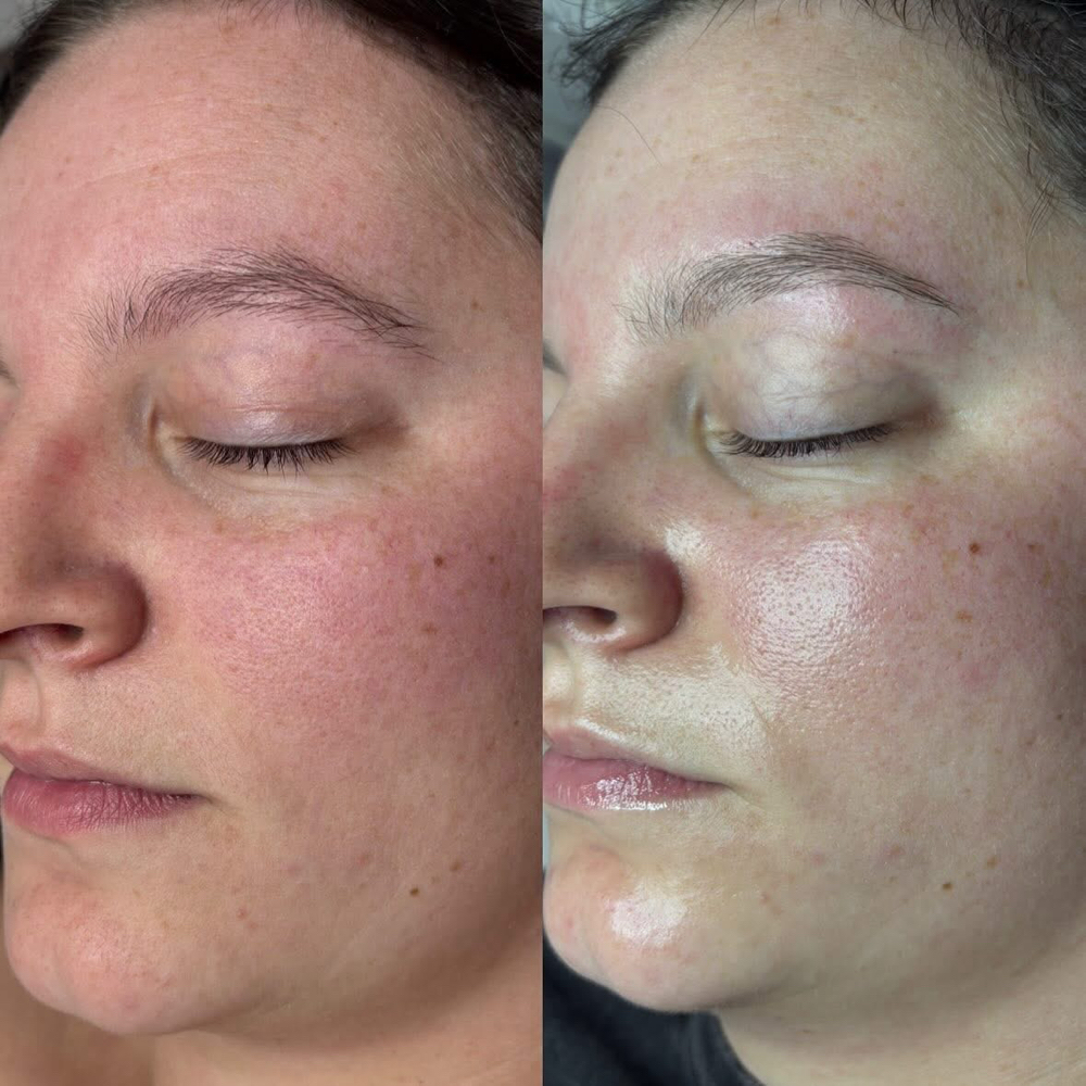 Glow Signature Facial at Heavenly Skin Spa in Shorewood, IL