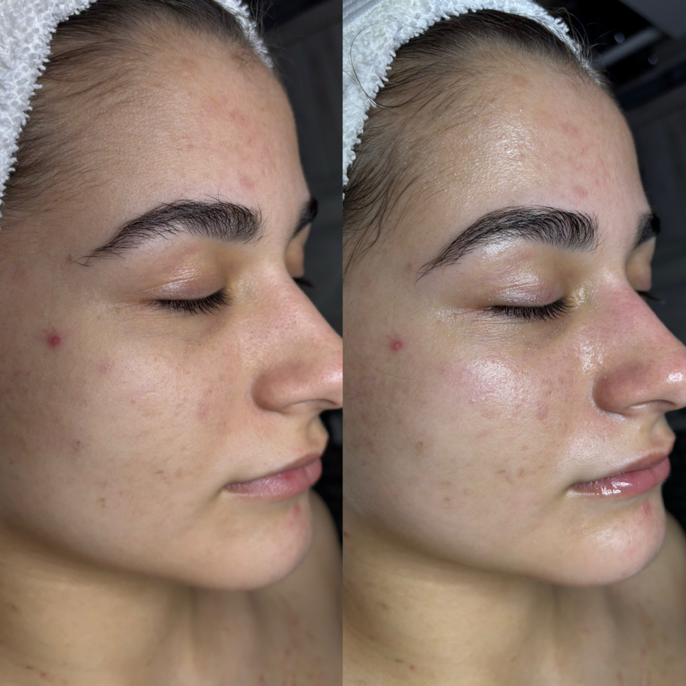 Glow Signature Facial