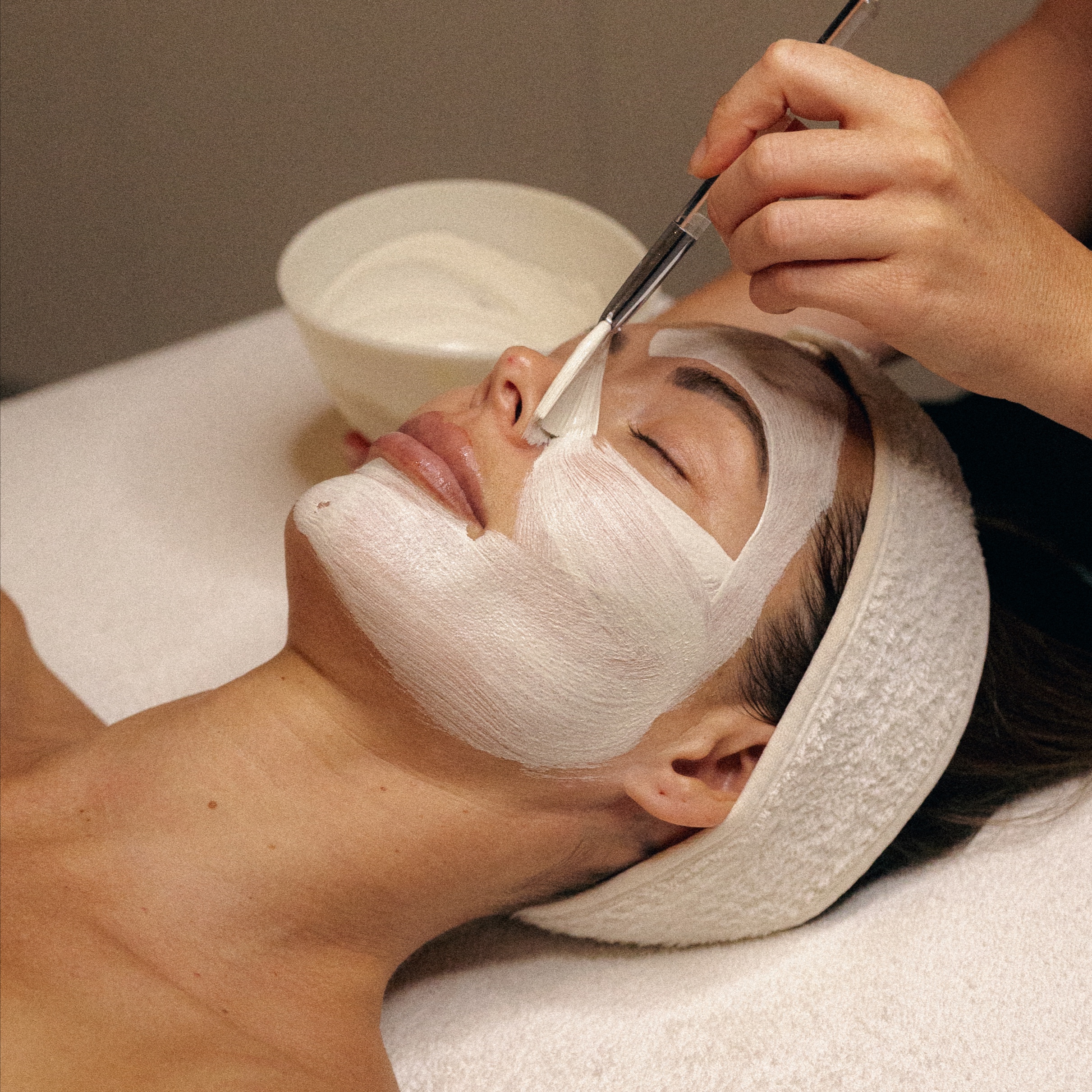 New Client Acne Consult + Treatment at Ruby Williams Aesthetics LLC in Sarasota, FL