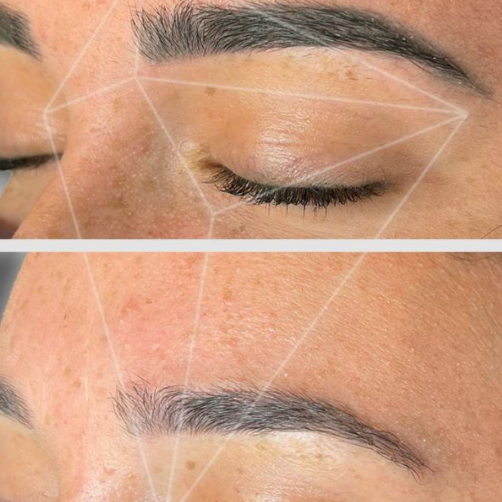 Brow Tattoo Removal at Blush Beauty & Aesthetics in North Olmsted, OH