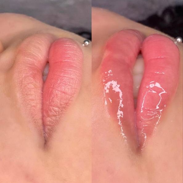 Hydra Lips at It's Brazilian Brows in Fresno, CA