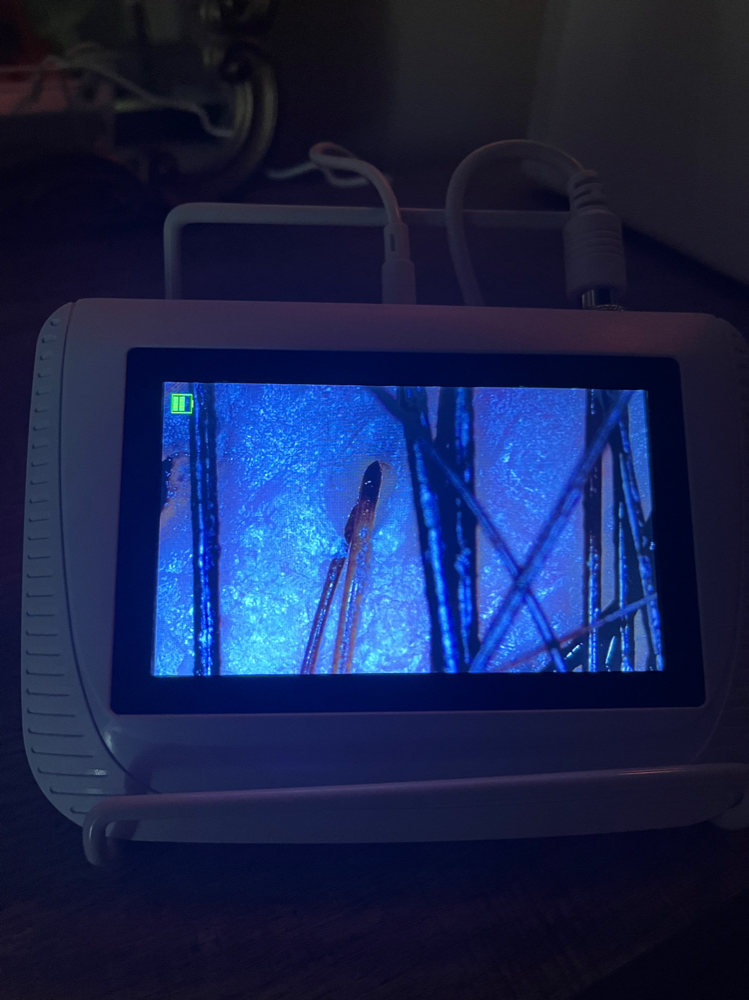 Scalp Analysis Only at Dream Holistic in Turlock, CA