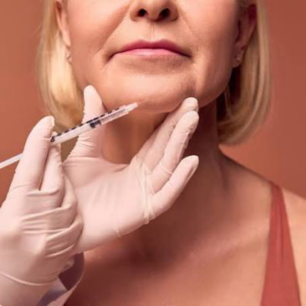 CHIN TOX at RGV PRIME AESTHETICS PLLC in Mcallen, TX