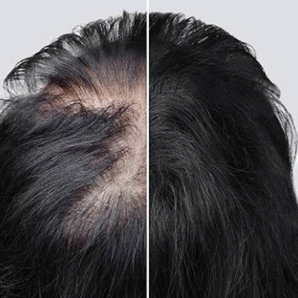 Hair Loss Prevention Consultation at L&O BeautyCollection in West Burlington, IA