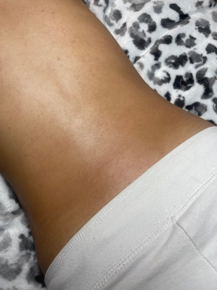 Lower Back Waxing