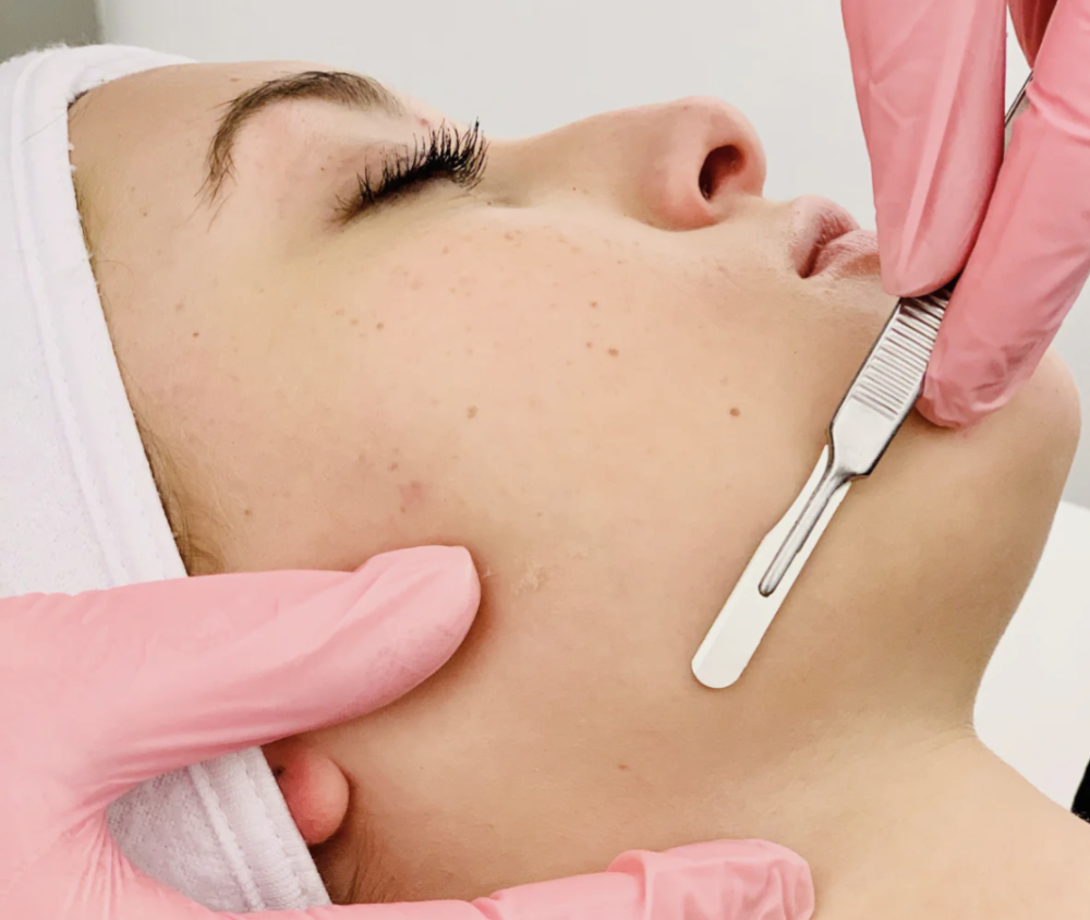 Dermaplane W/Face Mask (No Massage)