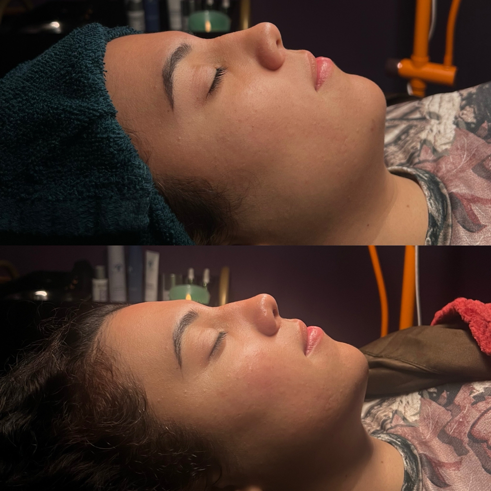 Midnight Glow at Skin Moon Rising in East Meadow, NY