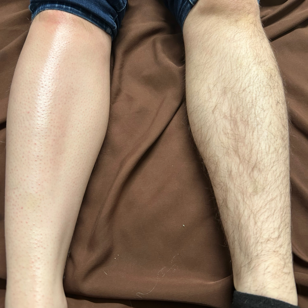 Waxing