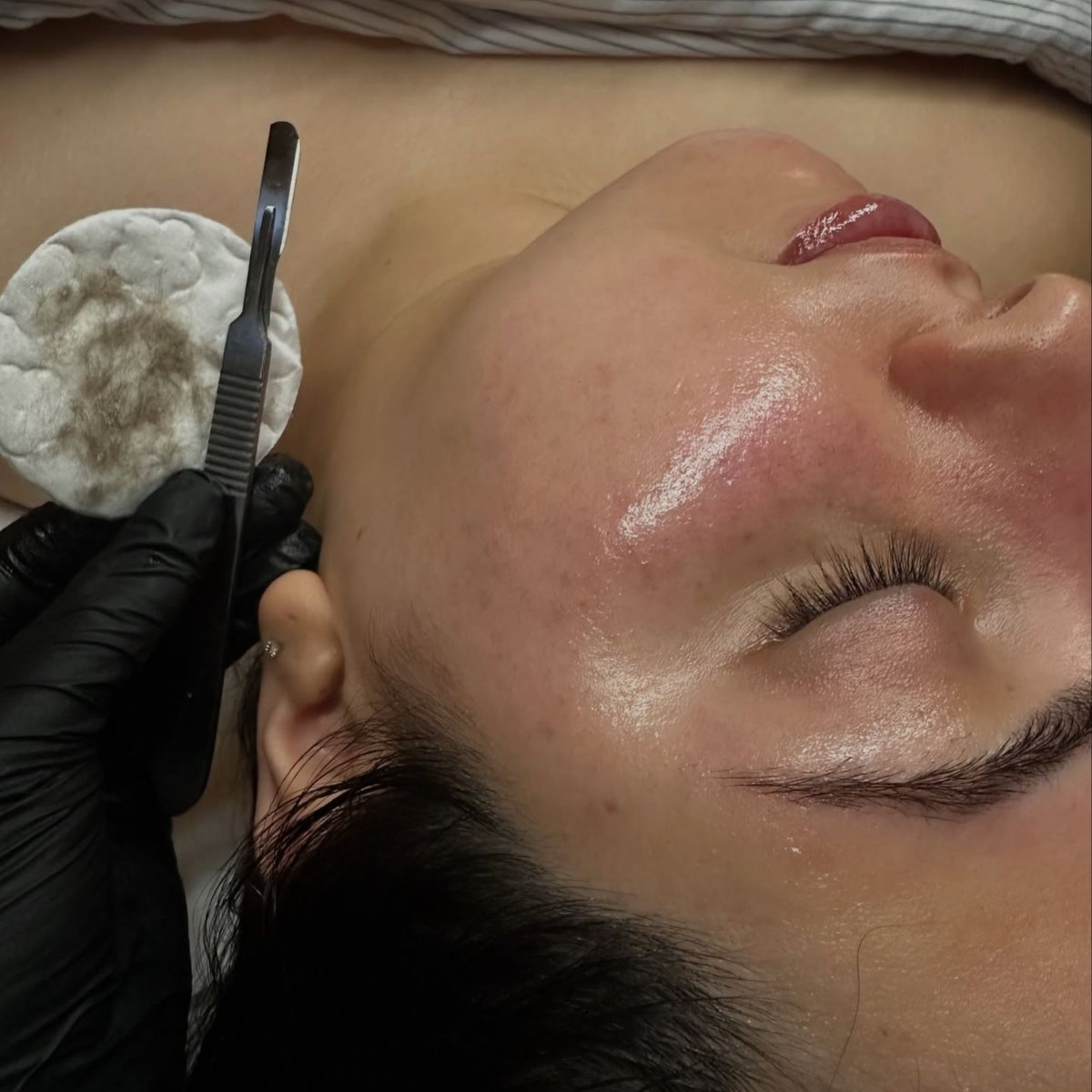 Smooth & Renew Dermaplaning Facial at AGELESS SKIN BY ASEEL MED SPA in Prosper, TX