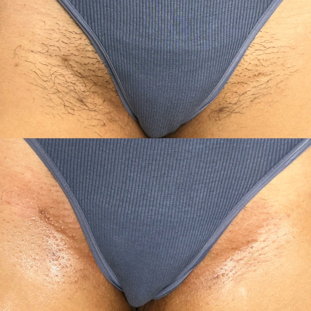Bikini Wax