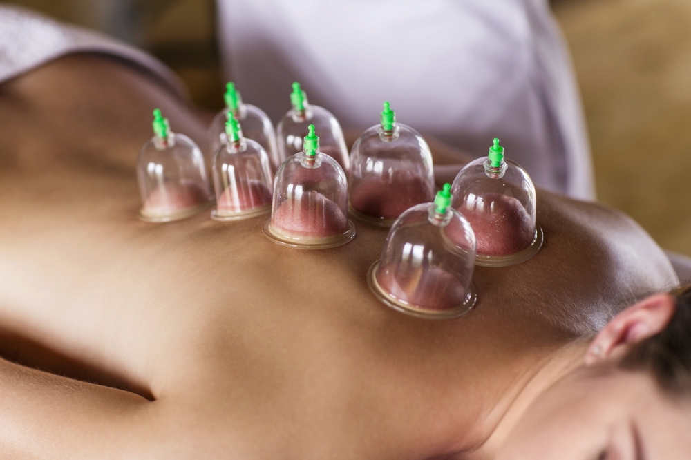 Cupping Massage- 75 Min