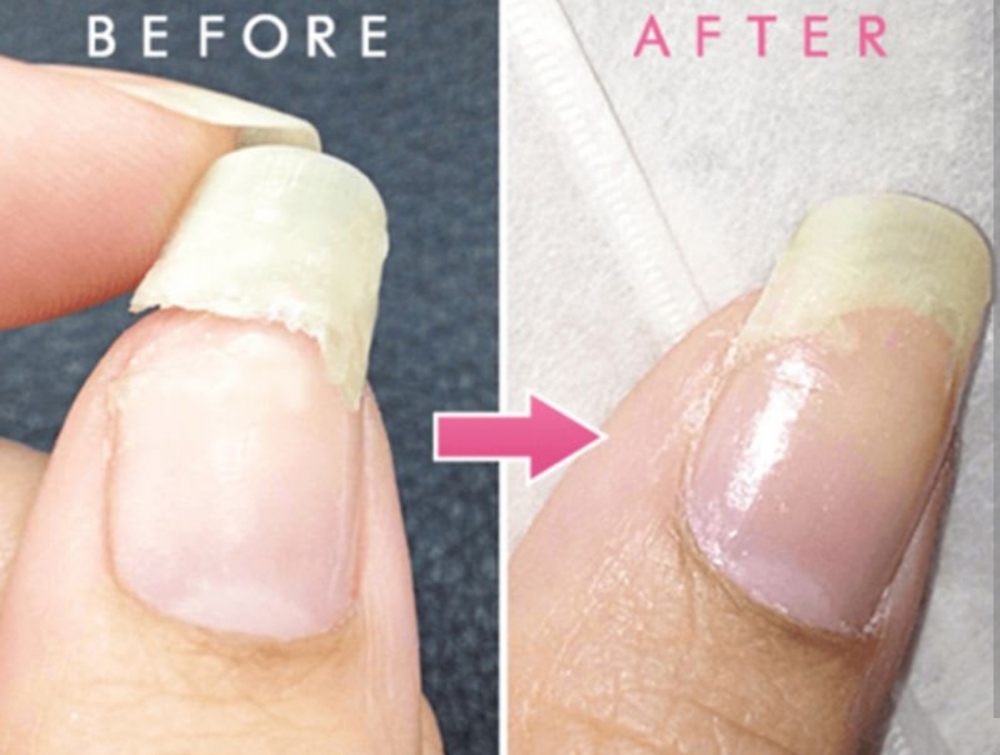 Repair Nail