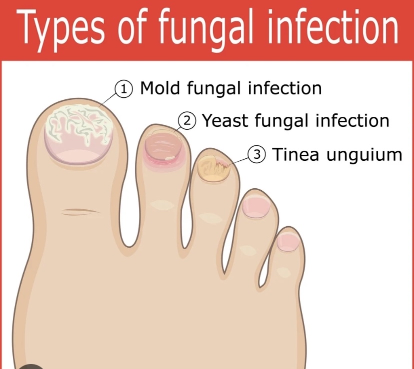 Medi-Pedi Level 2
