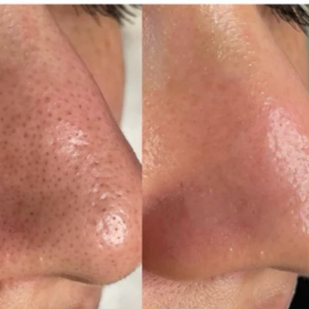 Cristal Clear at Sculpting Beauty by Pam LLC in Atascocita, TX