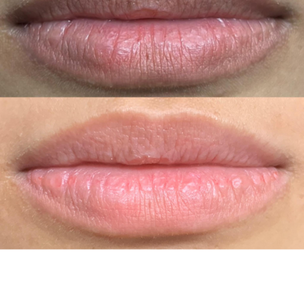 Lightening Dark Lip at Excellent Nails By Sandy in California, CA
