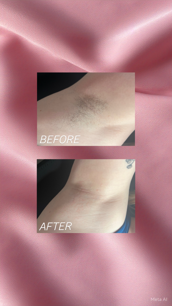 Underarm Wax