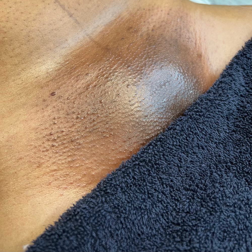 Brazilian Wax