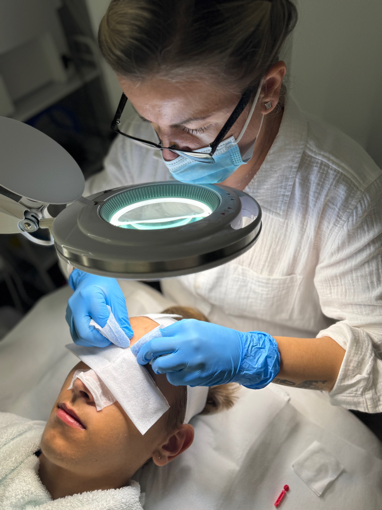 Pro-Acne Program (in person)