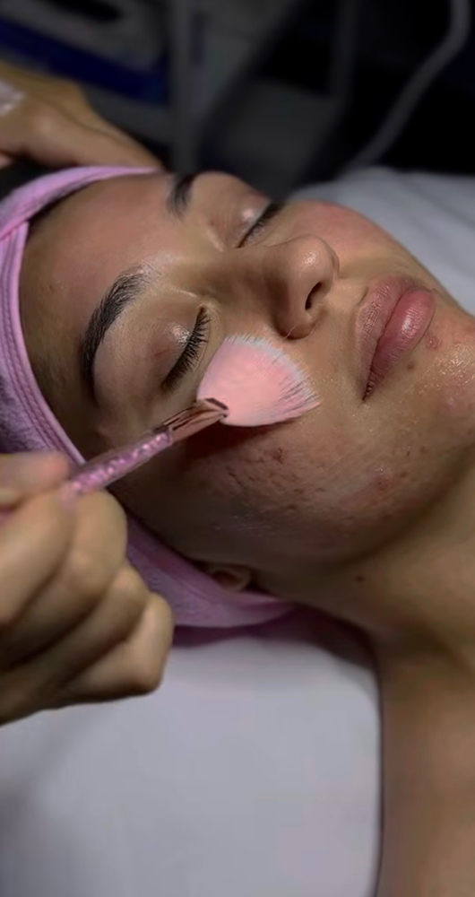 Acne Clarifying Facial at The One Aesthetics in Waco, TX