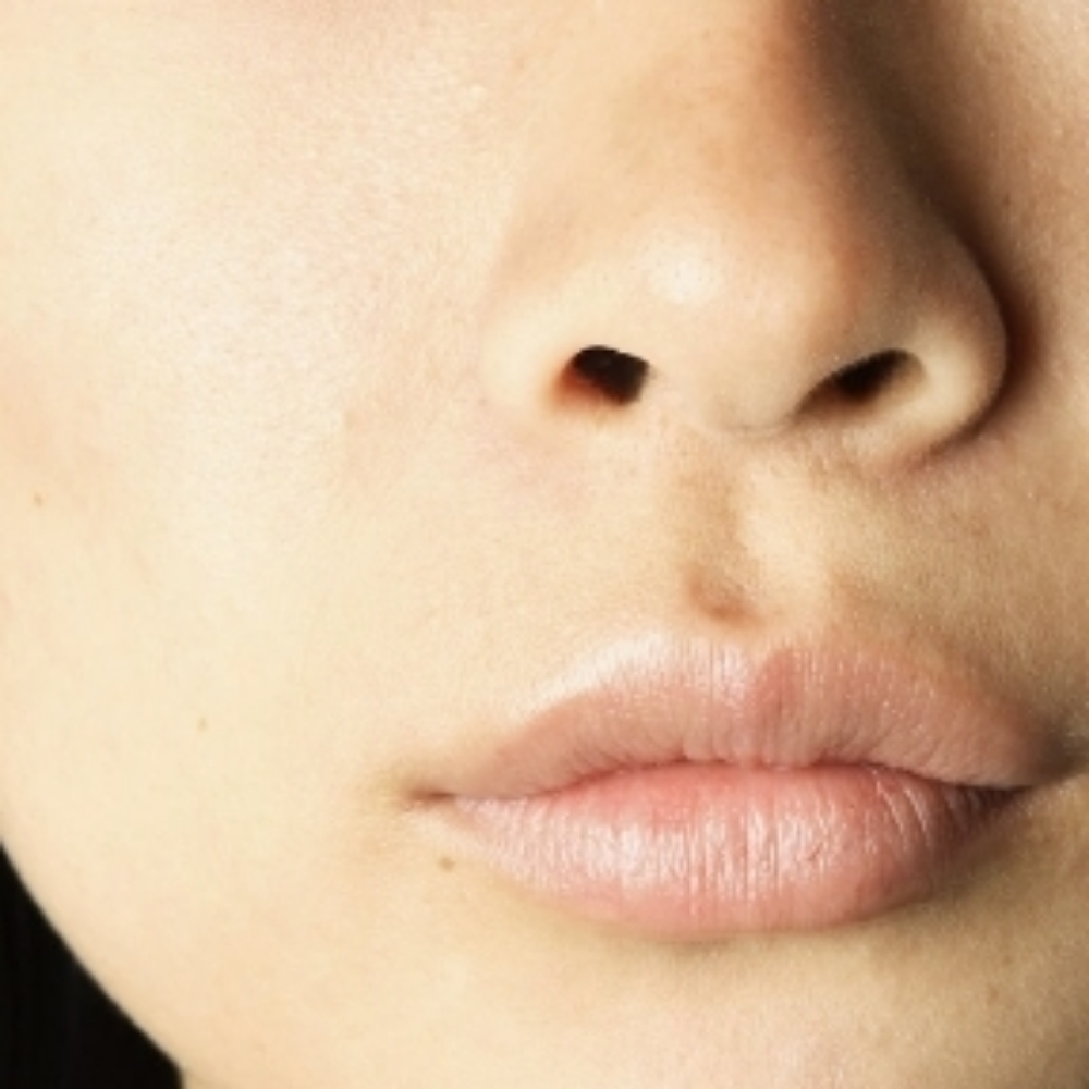 Wax Nose at Andrea Godsey in Mesa, AZ