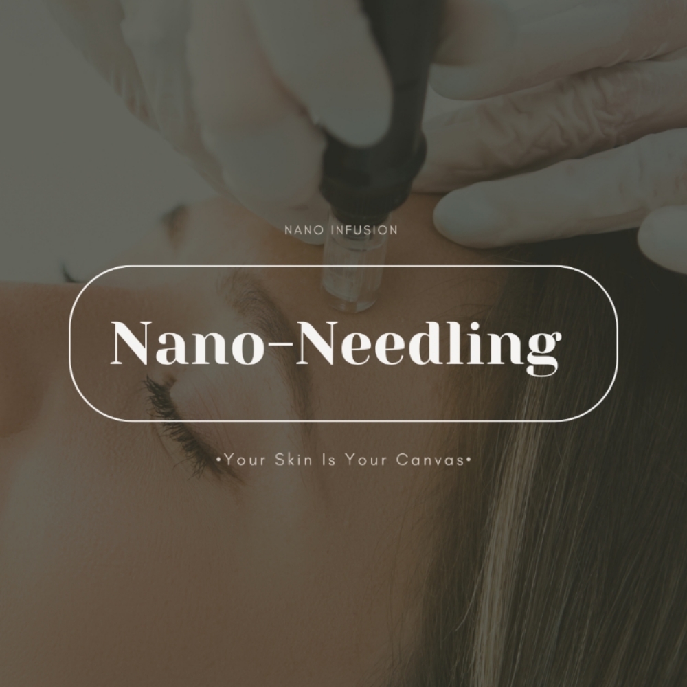 Nano-needling Infusion at Face Palette Aesthetics in Franklin, WI