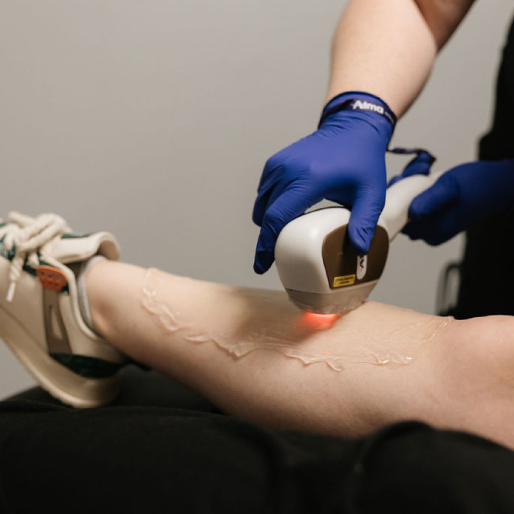 Laser Hair Removal at Angel Care Health and Wellness in Knoxville, TN