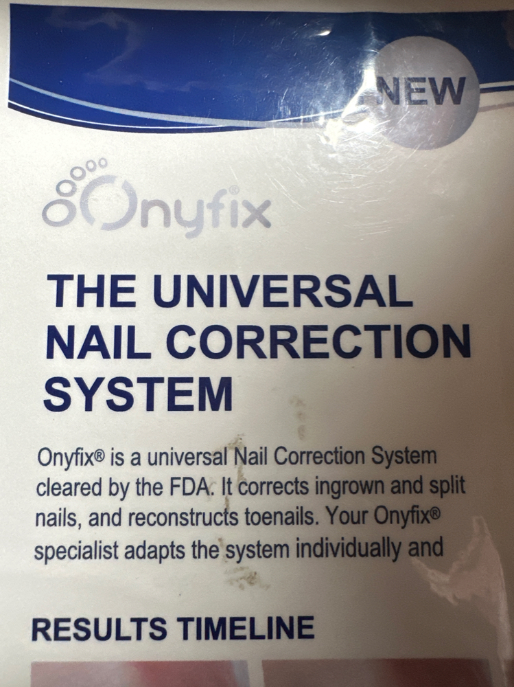 Onyfix1  band Univ Nail  Correction