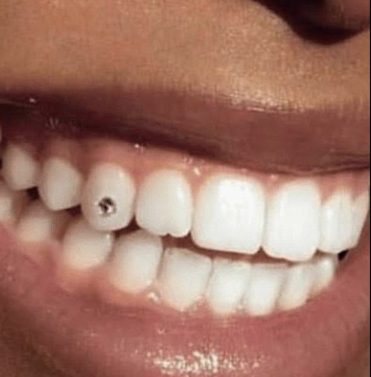 Tooth gem 💎