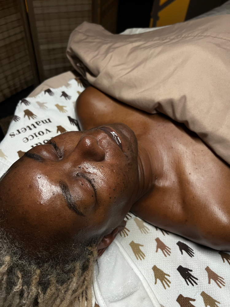 Level Three Chemical Peel