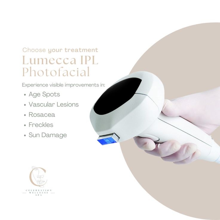 Lumecca IPL Photofacial