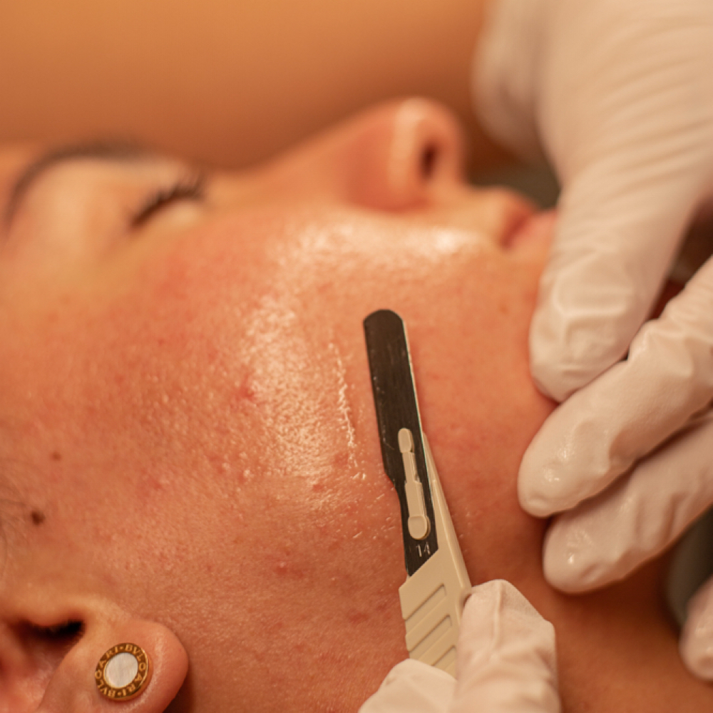 Derma-Deluxe at MySkin Aesthetics in Laredo, TX