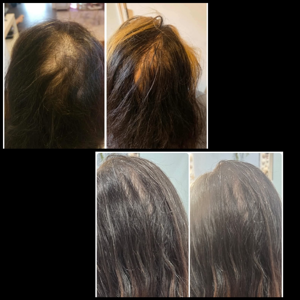 Hair Regenerative Skincare Service