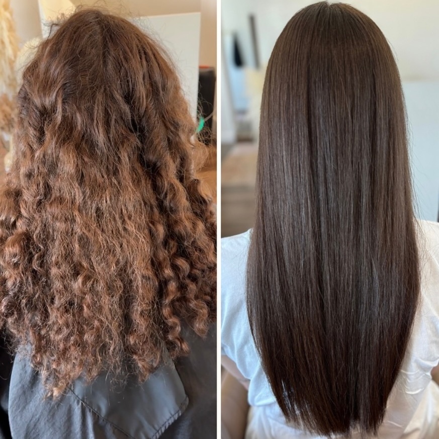 Stem Cell Smoothing Treatment at Lisabella Image Possibilitarian in Summerville, SC