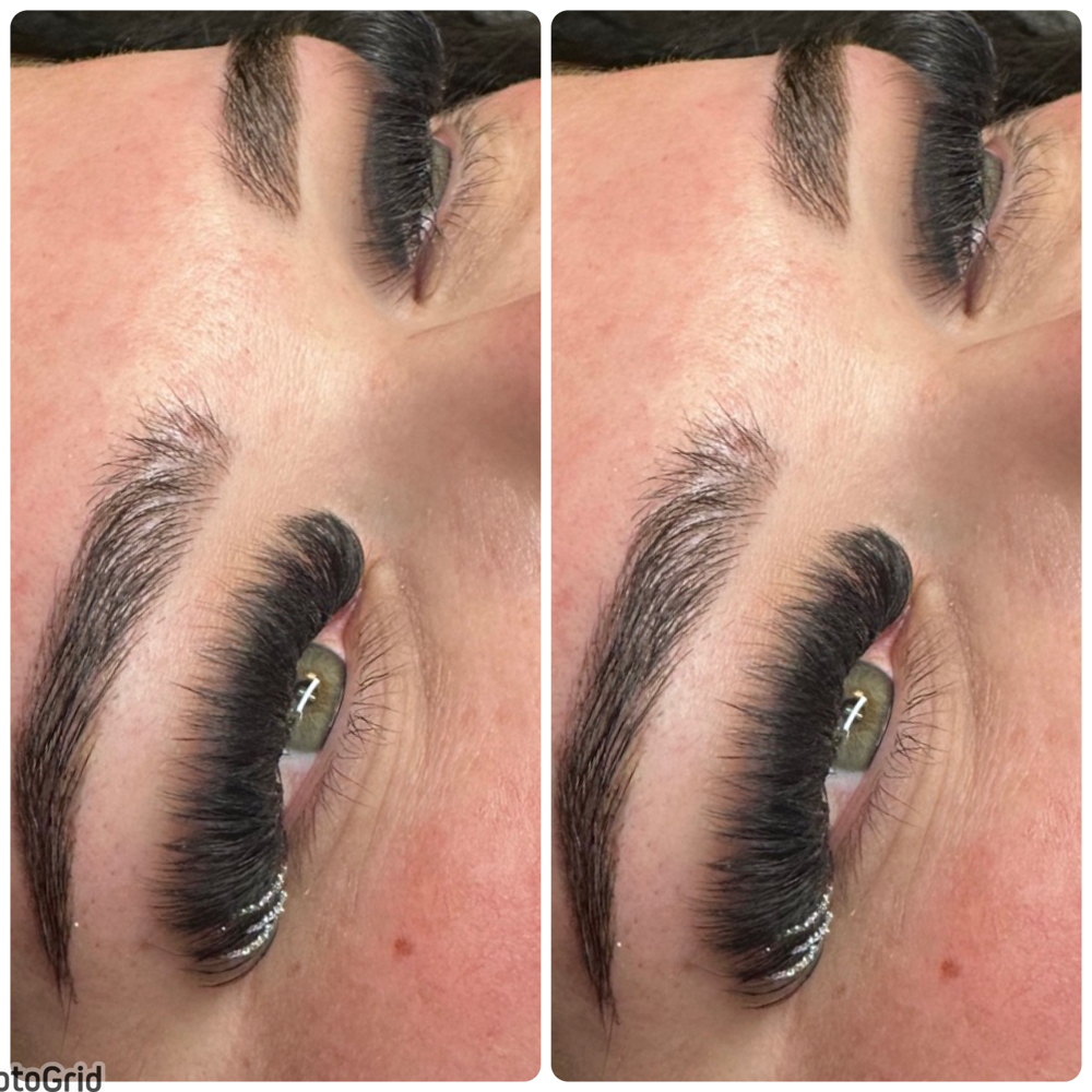 Mega Volume Fill