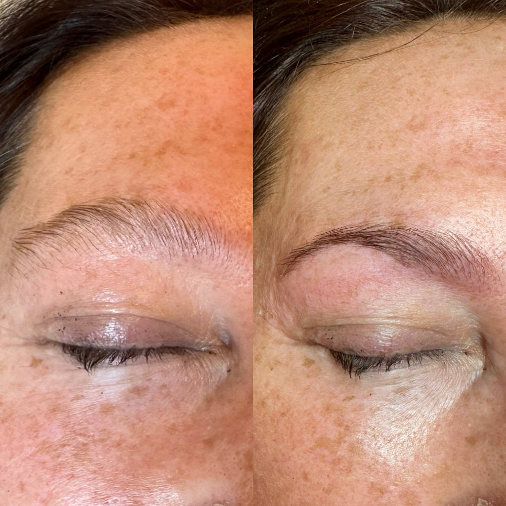 Brow Lamination