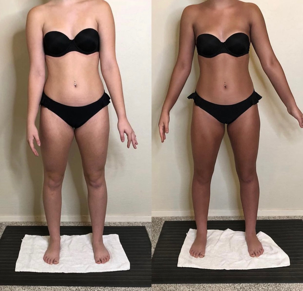 Spray Tan