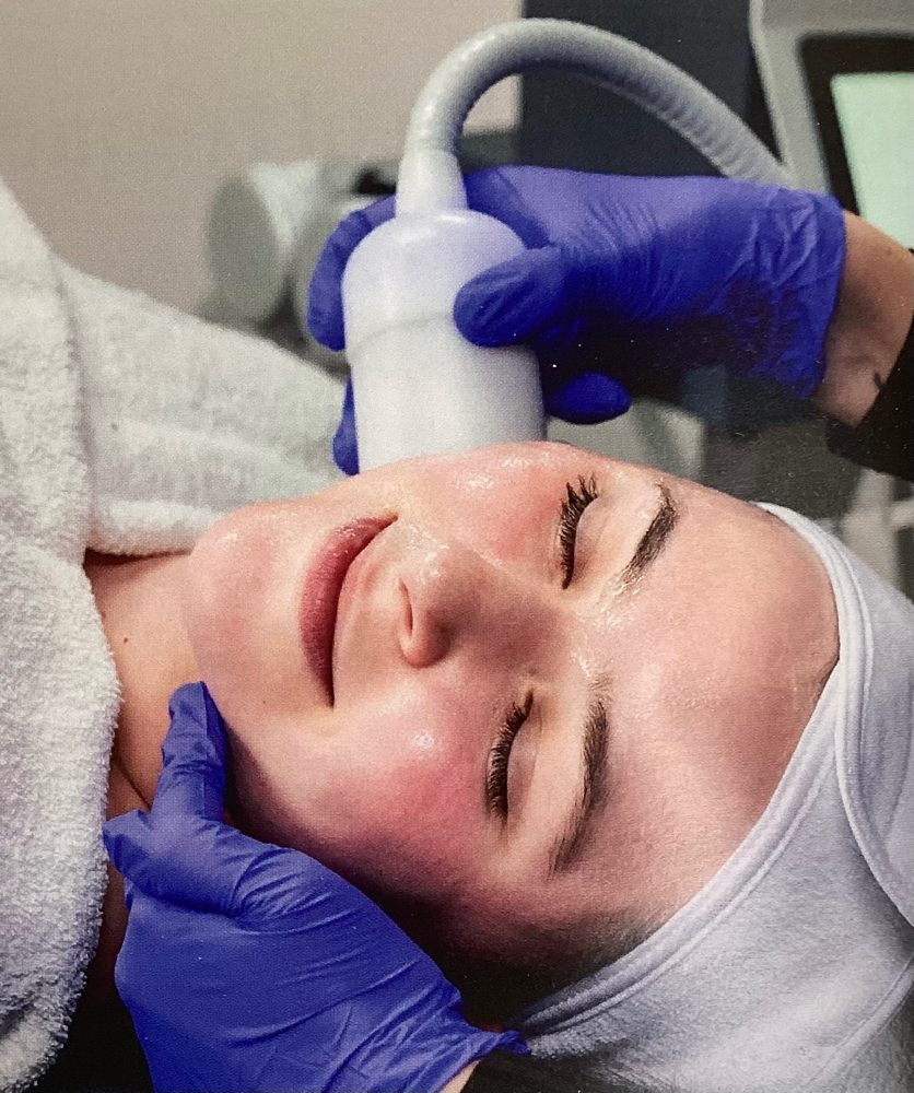 Collagen Boost Cryo-Facial